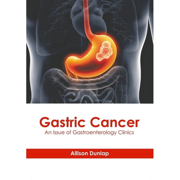 Gastric Cancer: An Issue of Gastroenterology Clinics, (Hardcover)