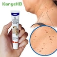 thumbnail image 1 of Ungüento para eliminar verrugas, crema para el tratamiento de verrugas, etiqueta para la piel del cuello, axila, verrugas planas, genitales, verrugas, pies, callos, crema médica para verrugas G001 kaili Sencillez, 1 of 5