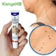 thumbnail image 1 of Ungüento para eliminar verrugas, crema para el tratamiento de verrugas, etiqueta para la piel del cuello, axila, verrugas planas, genitales, verrugas, pies, callos, crema médica para verrugas G001 kaili Sencillez, 1 of 5
