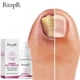thumbnail image 1 of Rtopr Ginger Nail Treat Ment Nail Toe Repair 10ml, 1 of 5