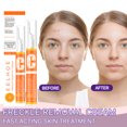 thumbnail image 5 of Crema aclaradora de manchas EELHOE VC: hidrata, reafirma e ilumina la piel, reduce la melanina, 5 of 5