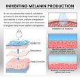 thumbnail image 3 of Suero corrector de manchas oscuras suero eliminador de melasma iluminador seguro hidratante suave para el hogar para el cuidado de la piel ANGGREK Otros, 3 of 8
