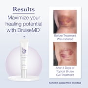 BruiseMD Topical Gel, Arnica & Vitamin K, Accelerate Recovery, 20g