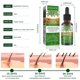 thumbnail image 5 of Pack de 2 Aceites de Romero para Estimular el Crecimiento y Nutrir el Cabello, 30ml, 5 of 7