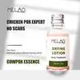 thumbnail image 1 of Suero para el acné Hidratante Hidratante y que desvanece las marcas del acné Facial suave, 1 of 6