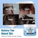 thumbnail image 4 of 1-5x Seborrheic Dermatitis Cream, Anti Fungal Shampoo, Scalp Treatment for Psoriasis, Folliculitis, Dry Scalp, Anti-Itch, Sooth, 4 of 5