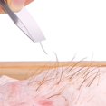 thumbnail image 4 of Metal Fish Bone Remover Chicken Plucking Feather Nipper Tweezers Kitchen Tool, 4 of 8