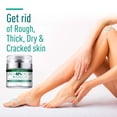 thumbnail image 1 of Fiudx Crema de Urea, Hidraste Intensivo para Pies, Fórmula Salicílica Suavizante de Callos, Solución Reparadora para Piel Seca, Cuidado Profesional de Uso Doméstico, Infusión de Aloe Vera y Árbol de, 1 of 7