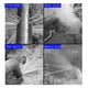 thumbnail image 3 of Detector De Fugas De Tuberías De Agua, Monitor De Fugas De Agua Operación Simple Detección Precisa Con Auriculares Para Sitio De Construcción, 3 of 7