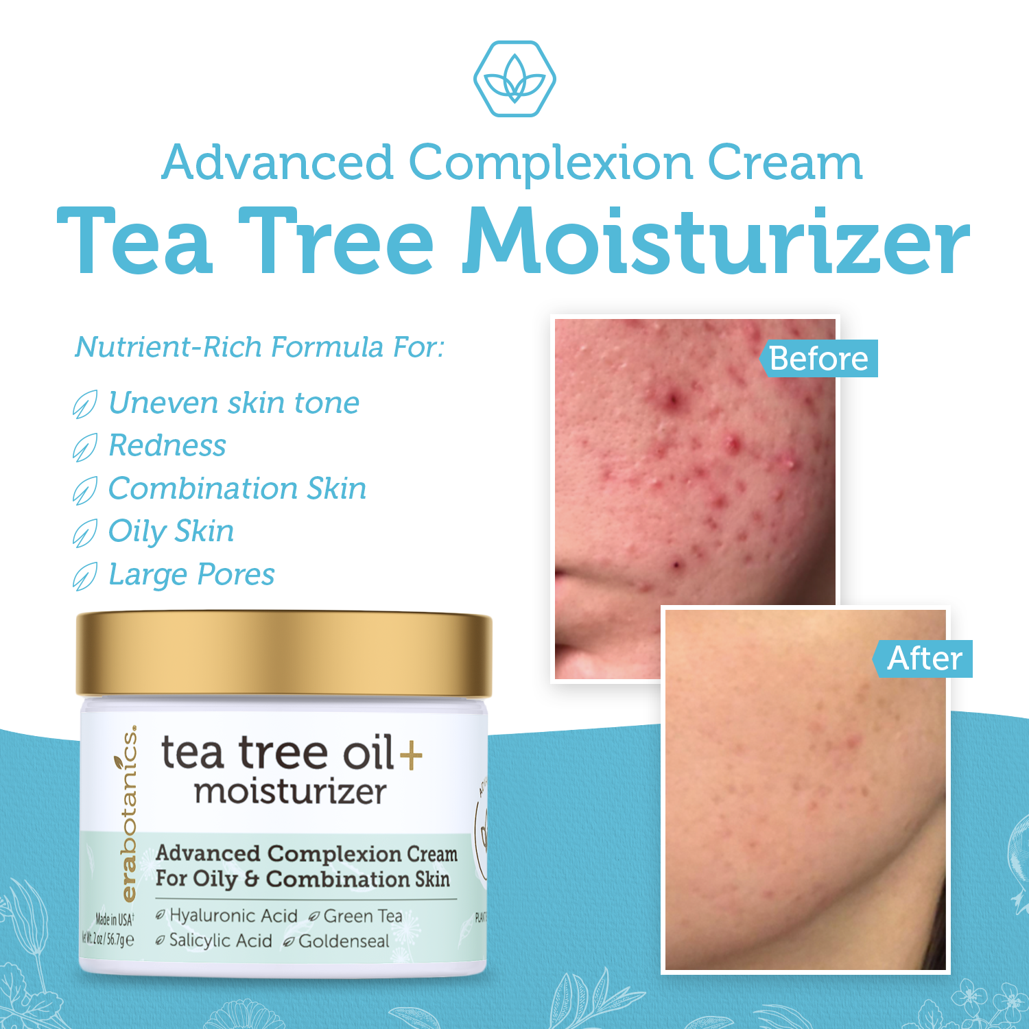 Era Organics Tea Tree Oil Face Cream - For Oily, Acne Prone Skin, Extra Soothing & Nourishing Non-Greasy Botanical Facial Moisturizer with 7X Ingredients For Rosacea, Cystic Acne, Blackheads & Redness - image 5 of 6