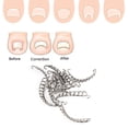 thumbnail image 4 of Alambre de corrección de uñas encarnadas para el cuidado de la recuperación Paroniquia File Patch Corrector Foot Pedicure Tool 24pcs Ofspeizc 220169, 4 of 8