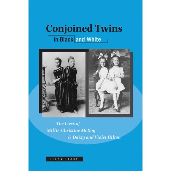 Wisconsin Studies in Autobiography Conjoined Twins in Black and White: The Lives of Millie-Christine McKoy and Daisy and Violet Hilton, (Paperback)