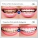 thumbnail image 5 of Livfresh Toothpaste Gel, Clinically Proven To Remove Plaque 250% Better, 5 of 5