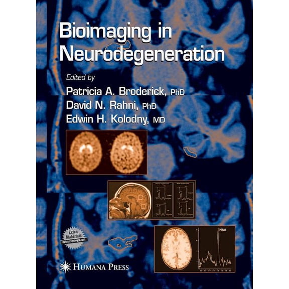 Contemporary Neuroscience Bioimaging in Neurodegeneration, (Paperback)
