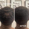 thumbnail image 4 of Hair Growth Oil for Fast growth, hair loss treatment, hair treatment, 4 of 11