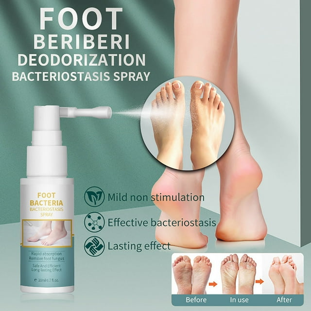 Crema de Beriberi En Aerosol para Eliminar El Mal Olor de Pies. Solución Activa En Aerosol (20 Ml) | Alivio Rápido Del Pie de Atleta | Aplicación Sin Contacto