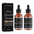 thumbnail image 1 of 2pcs Hair Growth Serum For Hair Loss And Hair Regrowth 30ml Ginger Hair Growth Oil For Thinning Balding Repairs Hair Follicles Hair Growth Treatment F, 1 of 5