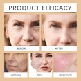 thumbnail image 4 of Crema facial reparadora con vitamina B5, crema facial calmante, crema de día para antienrojecimiento, hidratante, reafirmante, adecuada para pieles sensibles y nutritiva., 4 of 4