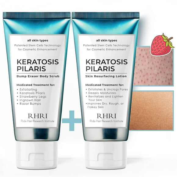 KP Bump Eraser Body Scrub | Keratosis Pilaris Treatment | Keratosis Pilaris Lotion | Exfoliating Body Scrub | Ingrown Hair Treatment | Bundle Set for Bump, Strawberry Le