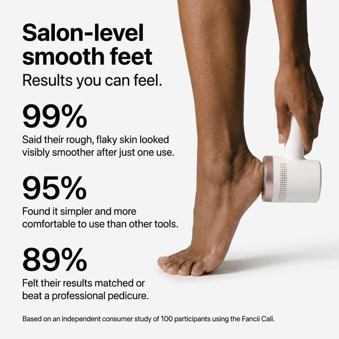 Fancii Cali Electric Foot File Callus Remover, Rechargeable with Built-in Vacuum – Mess-Free, Painless, Pedicure Tool for Smooth Feet  (Black)