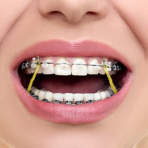 Orthodontic elastic bands outlet