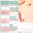 thumbnail image 3 of Scar Cream for Older Scar & New Scar, Scar Removal Cream for Scars, Burns, Stretch Marks, 50ml, 3 of 9