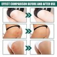 thumbnail image 5 of Crema hidratante para el cuidado de la cadera Jaysuing que atenúa las marcas de viruela, refresca y rejuvenece la piel, crema hidratante suave reparadora antiacné | | 100 ml |, 5 of 5