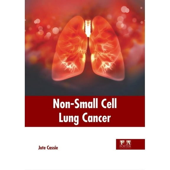 Non-Small Cell Lung Cancer, (Hardcover)