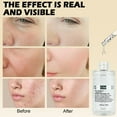 Again Beauty Korean Stacked Skin Care Korean Hydrating Toner Collagen