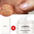 thumbnail image 1 of Lanbena Blackhead Remover Cream Pore Strips Nose Acne Deep Clean Peel Off Mask, 1 of 5