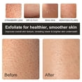 thumbnail image 4 of Guante exfoliante profundo coreano THURLADY Mitt, 3 unidades, 4 of 9