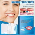 thumbnail image 2 of Kit de reparación temporal de dentadura postiza, relleno de dientes moldeable, pegamento sólido para dentadura postiza, 2 of 5