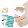 thumbnail image 4 of Kripyery 36Pcs/48Pcs/60Pcs/72Pcs/120Pcs Toenail Patches Self-Adhesive Three-Layer Fabric New Ingrown Toenail Corrector Sticker for Unisex, 4 of 7