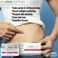 thumbnail image 3 of Skinception Intensive Stretch Mark Therapy Cream, 4 Fluid Ounce, 3 of 6