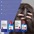 thumbnail image 4 of Seleniums Disulfide Shampoo Helps Control Oil, Deep Moisture Refreshing Dandruff Control Hair Wash, For Men Women, 4 of 5
