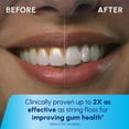 thumbnail image 6 of Waterpik Cordless Portable Water Flosser with 2 Tips, ADA Accepted, White and Blue, 6 of 14
