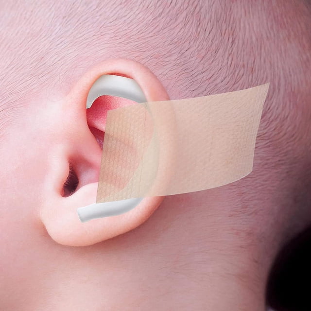 1 Rollo De Corrector Estético De Orejas De Bebé Parche De Corrección De Aurícula De Silicona Infantil, Corrector Estético Para Bebés Con Un Par De Soportes Para Las Orejas, Marrón