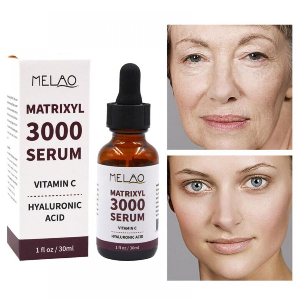 MATRIXYL 3000 Serum Vitamin C Hyaluronic Acid Reduce Sun Spots And