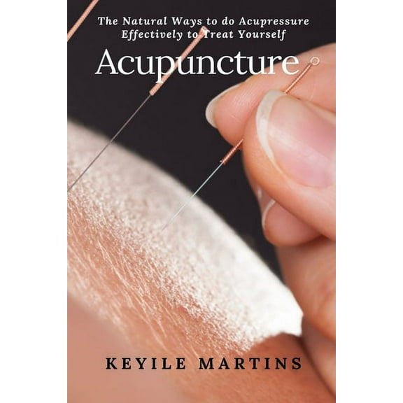 Acupuncture: The Natural Ways to do Acupressure Effectively to Treat Yourself, (Paperback)