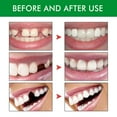 thumbnail image 2 of Kit de Remplacement de Dents Temporaires, Temp Dentaire, Plus Que les Autres, 2 of 12