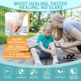 thumbnail image 5 of Silicone Scar Tape for Mark Fading - Easy Cutting Silicone Strips for Body Skincare & C-Section Comfort - Waterproof Protective Skin Barrier Roll for Sensitive Skin, 5 of 6
