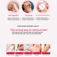 thumbnail image 4 of SIEYIO Cordless Shaver & Epilator for Women Gentle Hair Removal Electric Tweezers for Facial Hair Removal Epilators Legs, Arms,, 4 of 17
