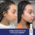 thumbnail image 3 of Palmer's Skin Success Dark Spot Corrector Fade Serum, 1 fl.oz., 3 of 8