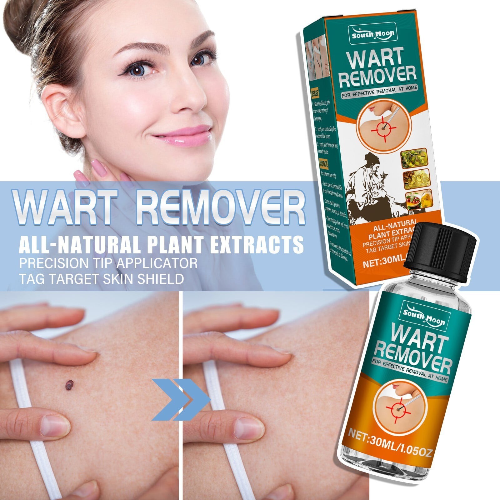 Where To Buy Skin Tag Remover Buy Skin-Tag-Remover Wart-Remover-Freeze-off Skin-Tag-Removal-Treatment