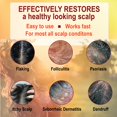 thumbnail image 2 of Bálsamo labial Kind Lips - Cuidado labial nutritivo e hidratante para labios secos hecho de manteca de karité, cera de abejas con vitamina E | Sabor de variedad navideña | 0,15 onzas (paquete de 4), 2 of 5