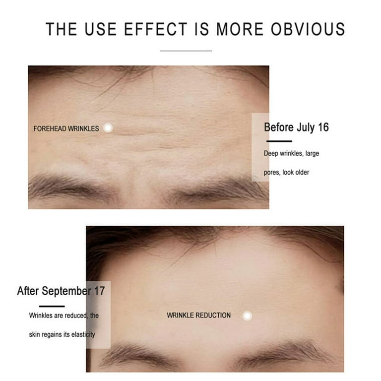 Forehead wrinkles cream deals