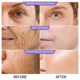 thumbnail image 4 of Esencia Facial antiarrugas de Retinol, ácido hialurónico hidratante, levanta líneas finas, reafirma la piel, antienvejecimiento, cuidado de la piel, 4 of 4