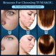 thumbnail image 5 of Varita facial de alta frecuencia - TUMAKOU Máquina facial portátil de mano azul de alta frecuencia - 4 tubos de vidrio azul diferentes para la piel, 5 of 5