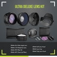 thumbnail image 2 of Kit de lentes Big Mike's Ultra Deluxe para Canon Rebel T3-T7i EOS 80D, 2 of 8