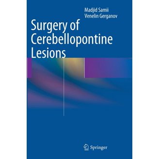 Congenital Diseases in the Right Heart, (Hardcover) - Walmart.com